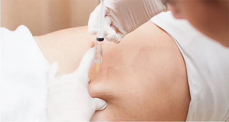 fat dissolving injection
